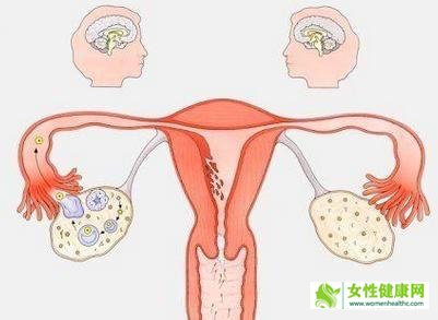 如何治疗卵巢早衰呢?卵巢早衰与女性压力有关吗?